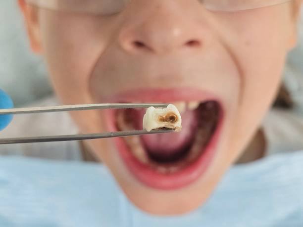 Best Emergency Orthodontic Repairs in Nes, IL